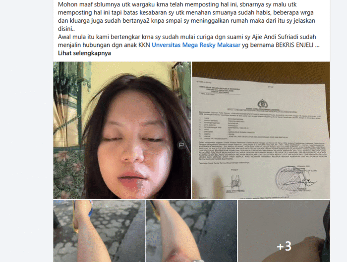 Rekaman layar bukti visum dan luka-luka yang diperlihatkan Dini Angraeni yang dianiaya Kepala Desa di Bantaeng.