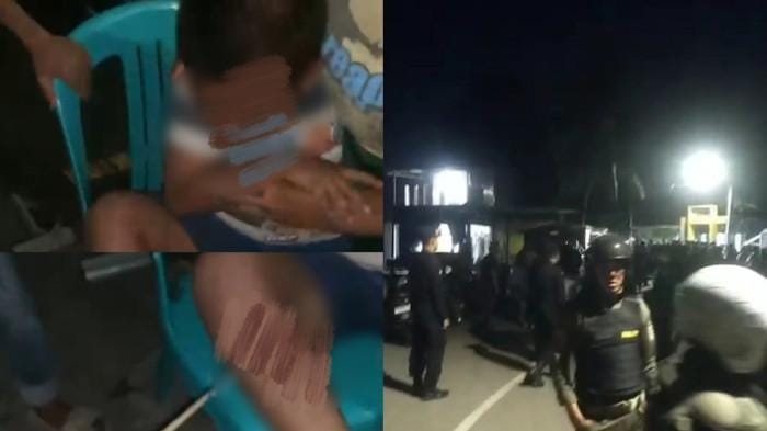 Bocah kena busur di Jalan Kandea, Kecamatan Tallo kota Makassar. Kejadian ini memicu perang kelompok di kawasan itu.