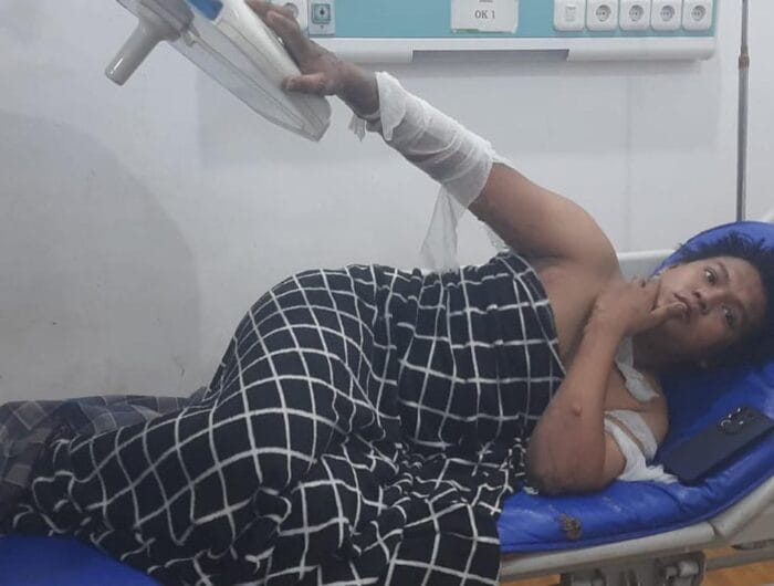 KORBAN. Seorang mahasiswa di Makassar menjadi korban lemparan molotov oleh OTK.