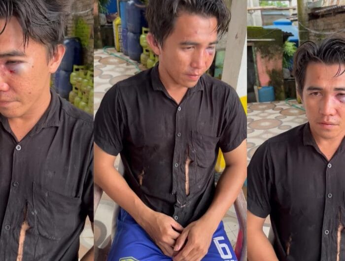 Akbar yang menjadi korban pengeroyokan oknum polisi di Kabupaten Maros.